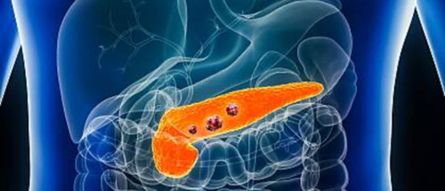 <p>Answer: Pancreas.</p><p>Rationale: Diabetes affects the pancreas, which produces insulin to regulate blood sugar levels​</p><p>Memory Tip: "Pancreas produces insulin" (both start with "P").</p>