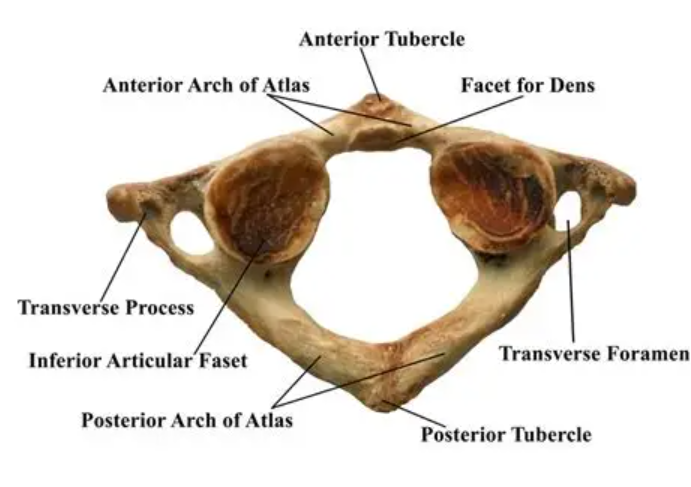 <p>The first cervical vertebra, known as the atlas, supports the skull and allows for the nodding motion of the head. It has a unique ring-like structure and lacks a body, facilitating the connection between the skull and the spinal column. </p>