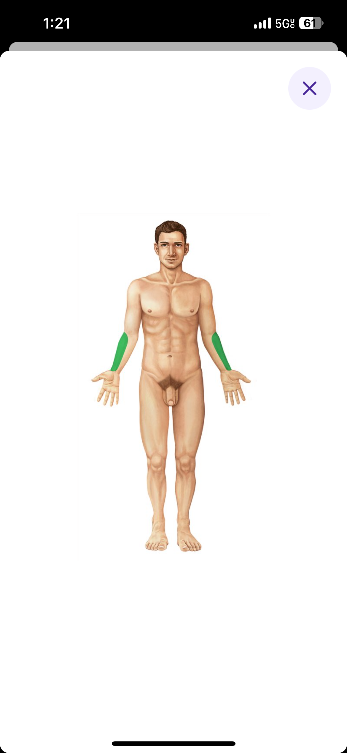 <p>Forearm the is on the same side as the thumb</p>