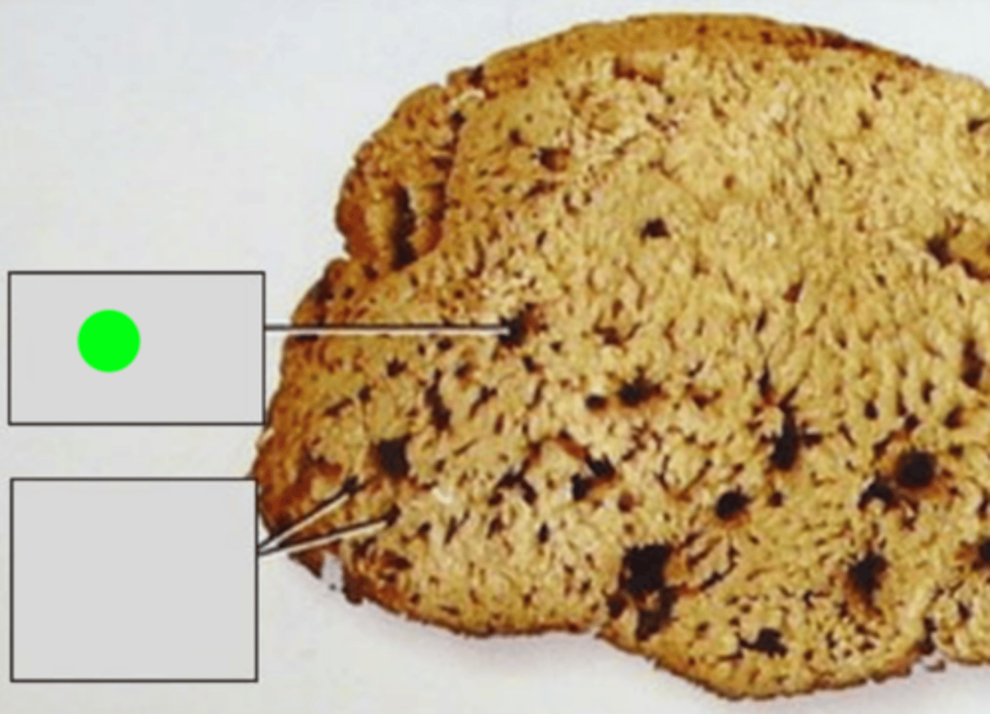 <p>Large opening in a sponge's body through which water exits after passing through the choanocyte-lined chambers and the spongocoel. It serves as the exit for water containing waste and carbon dioxide.</p>
