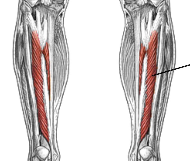 <p>Which muscle of the foot/ankle is:</p><ul><li><p>On posterior tibia</p></li><li><p>Deep to gastrocnemius and soleus</p></li><li><p>Action: foot inversion</p></li><li><p>Nerve: <span style="color: yellow;"><span>tibial</span></span></p></li></ul><p></p>