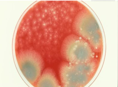<p>Aspergillus fumigatus</p>