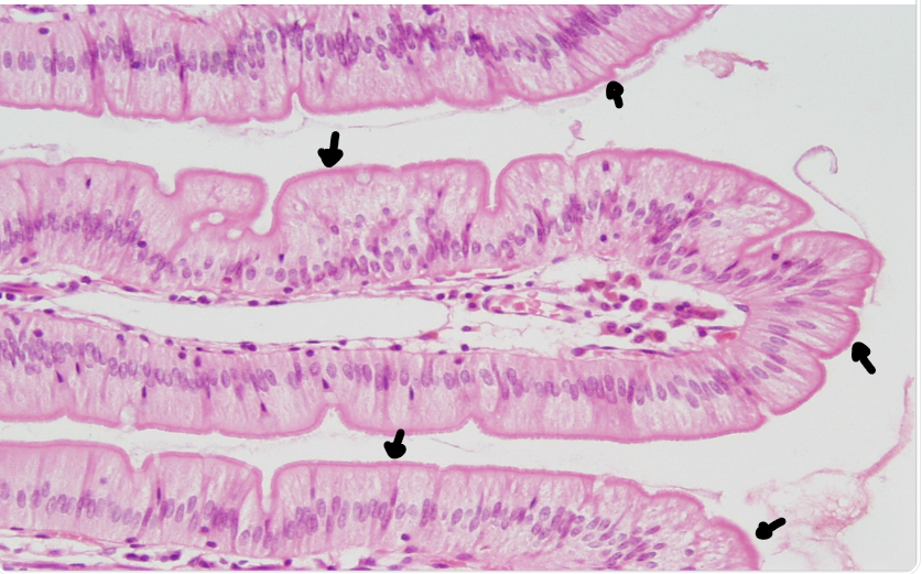 <p>the arrows point to</p>