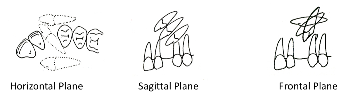 <p><strong>Horizontal</strong> plane- palatal, Buccal, intermediate</p><p><strong>Sagital</strong>- upper, leveled or lower to adjacent apex</p><p><strong>Frontal</strong>- vertical if less than 45 degrees, horizontal if over, angulated at 45</p>