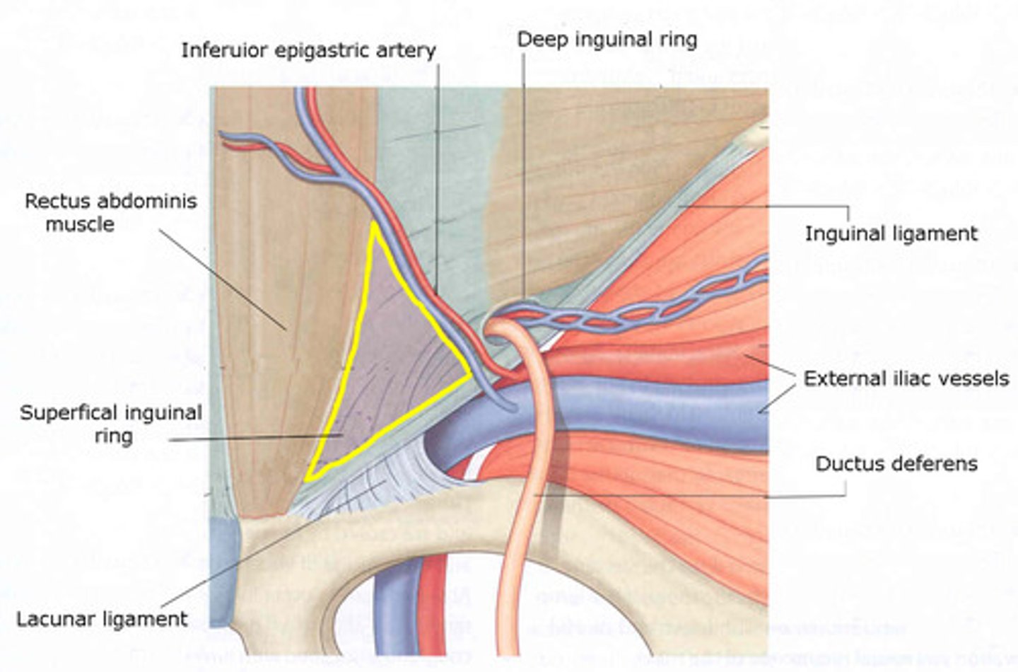 <p>Inf: Inguinal ligament</p><p>Lat: inf epigastric vessels</p><p>Med: Rectus abdominis</p>