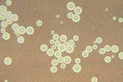 <p>Si observas esta tinción al microoscopio, indica:<br>- Nombre de tinción<br>- Aplicación<br>- ¿De qué especie de las vistas en el lab podría tratarse?</p>