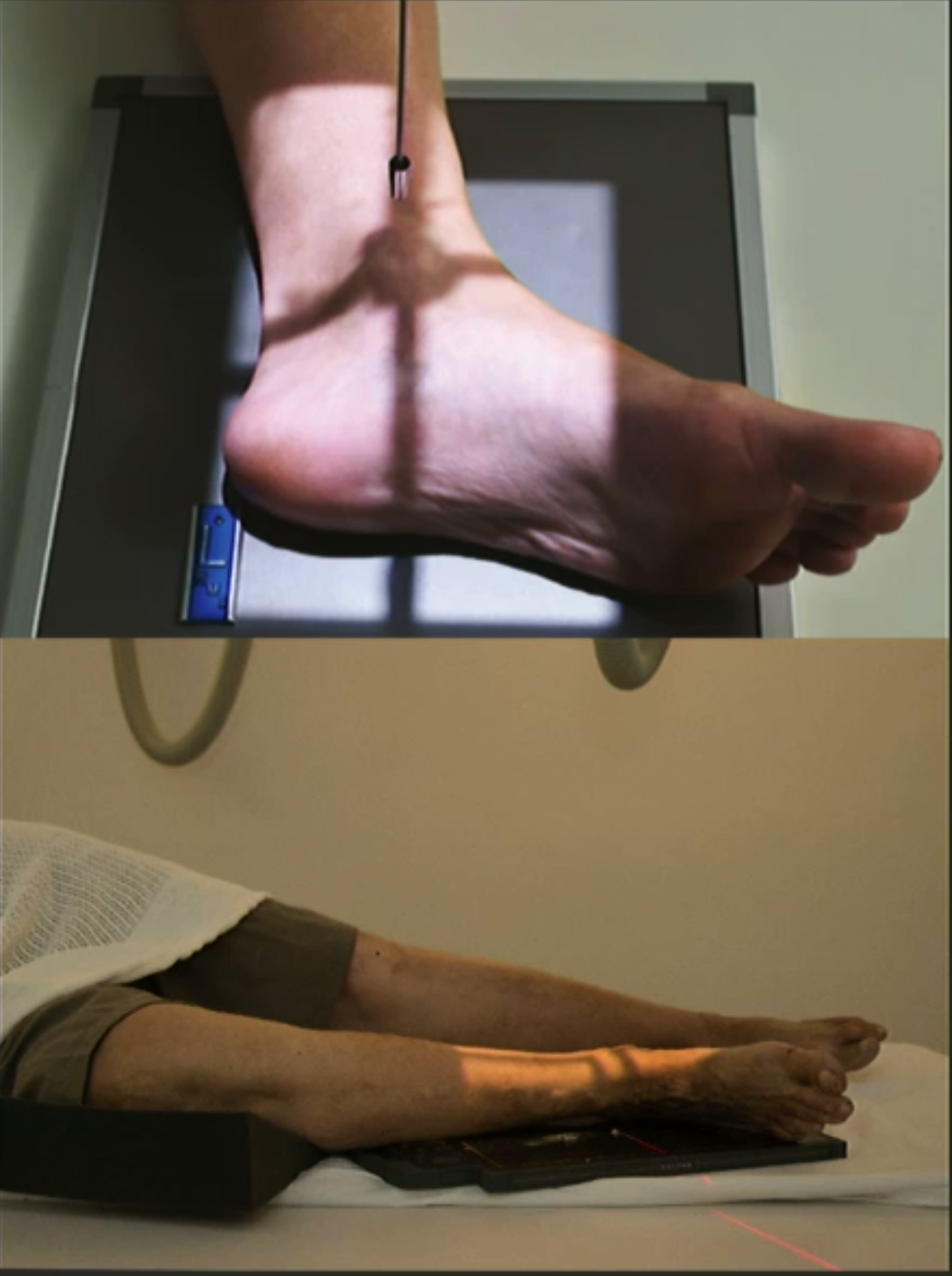 <ul><li><p>Knee flexed with leg externally rotated.</p></li><li><p>Dorsiflex foot with plantar surface perpendicular to IR.</p></li><li><p>Superimpose malleoli.</p></li><li><p>CR perp. to IR, centre over medial malleolus.</p></li><li><p>Collimate for skin edge posteriorly, midfoot anteriorly, and distal 1/3 of tib+fib.</p></li></ul><p></p>