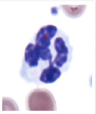 <p>What kind of granulocyte is indicated in the image?</p>