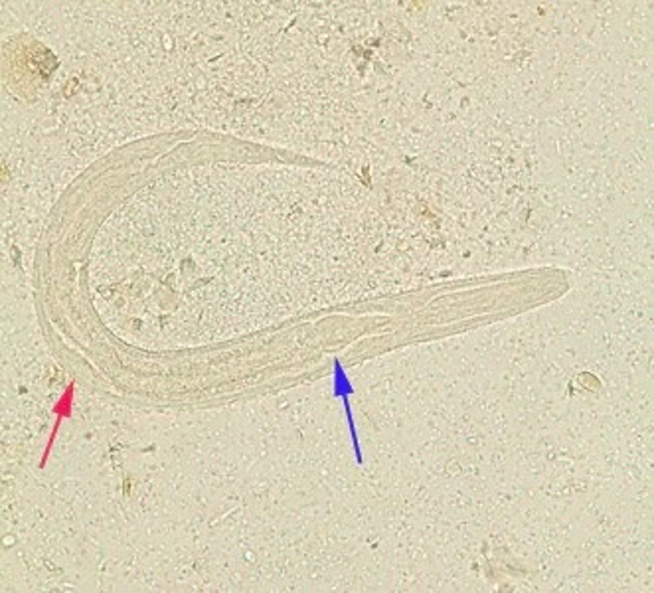 <p>Long genital primordium</p>