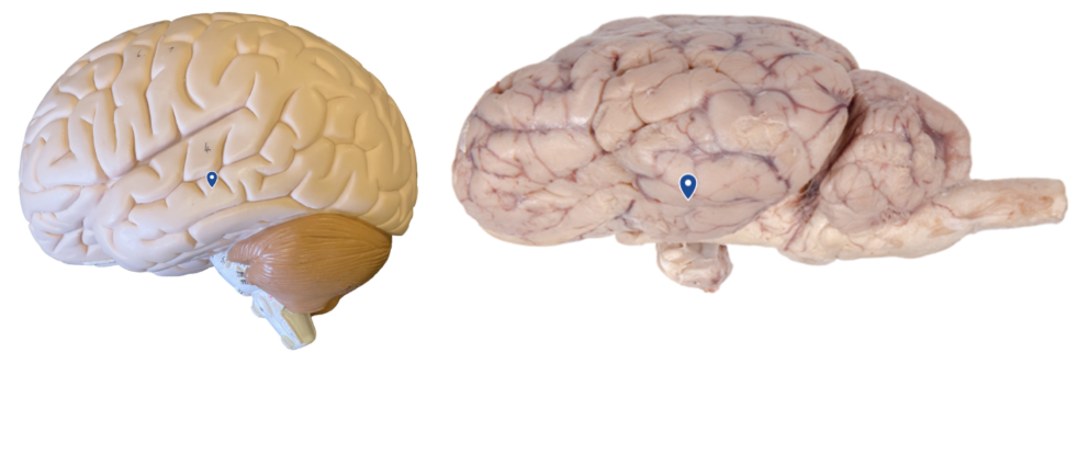 <p>What lobe is the arrow pointing to?</p>