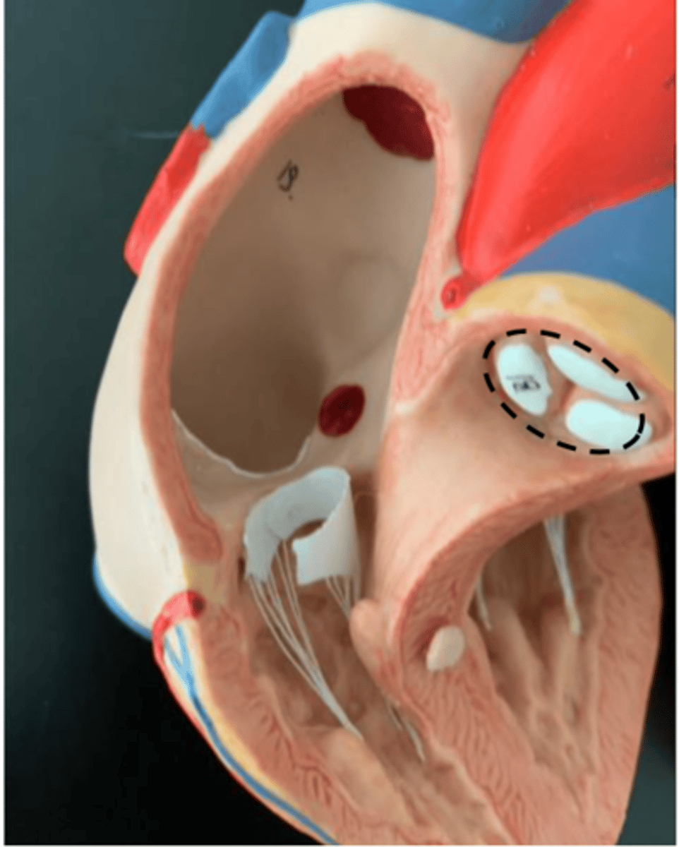 <p>valve inside the pulmonary trunk (no strings attached)</p>