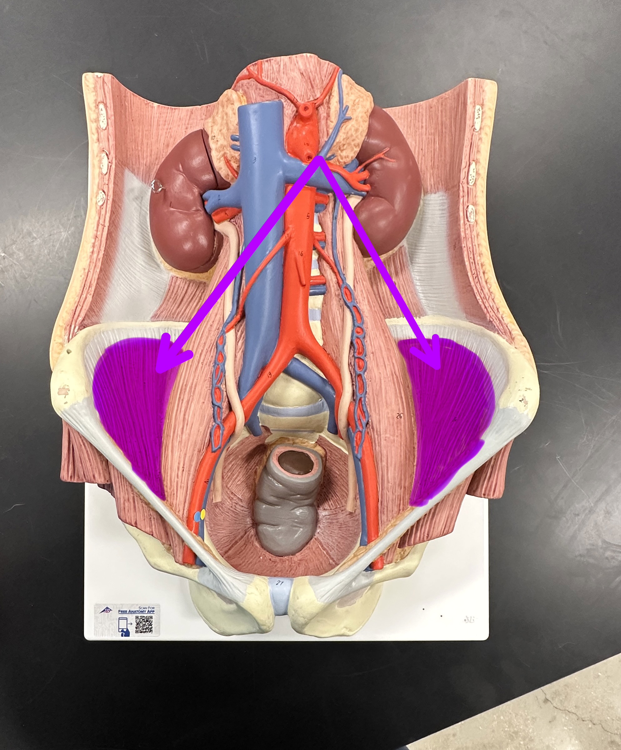 <p>What is the highlighted structure</p>