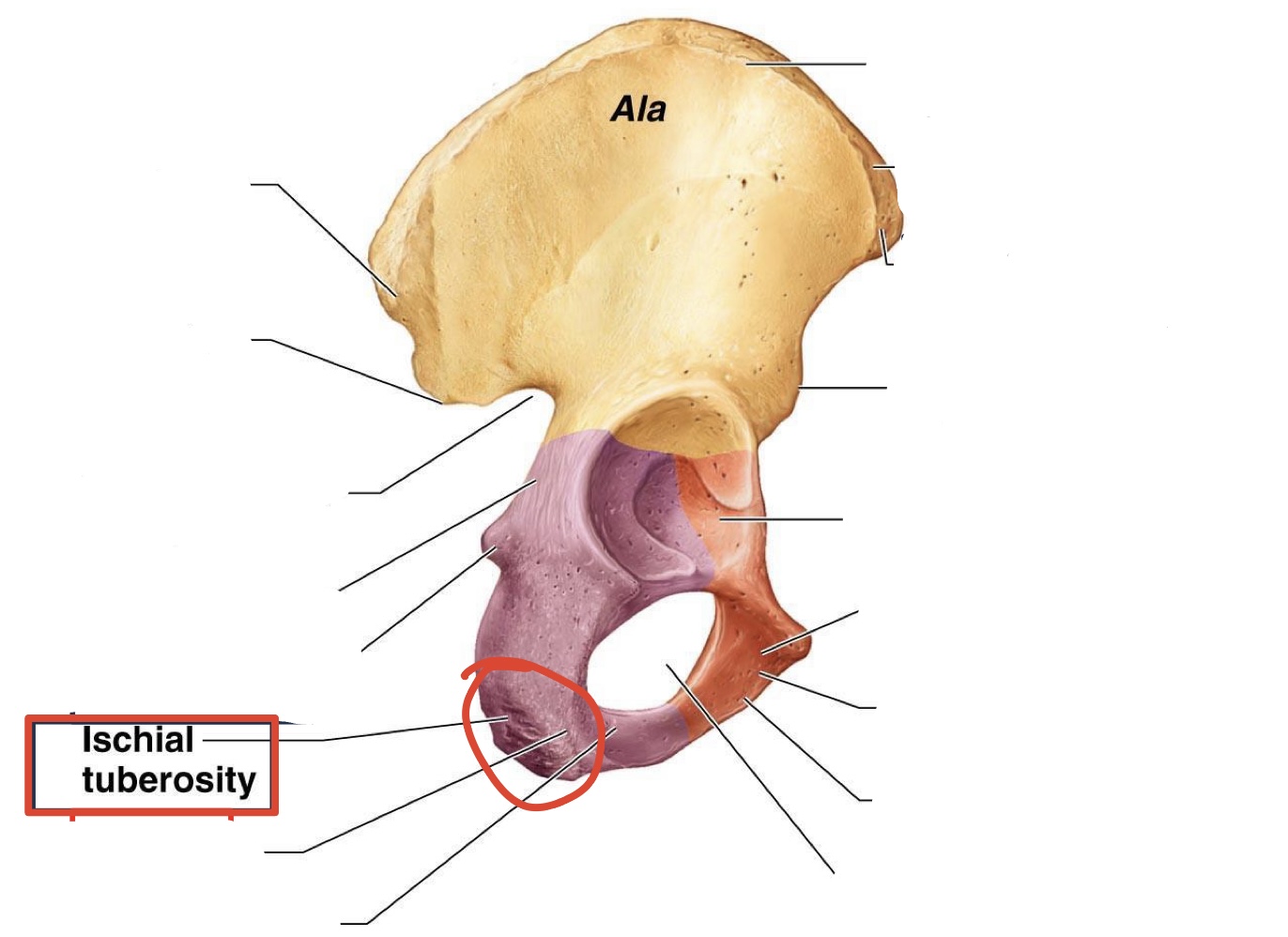 <p>Ischial tuberosity </p>