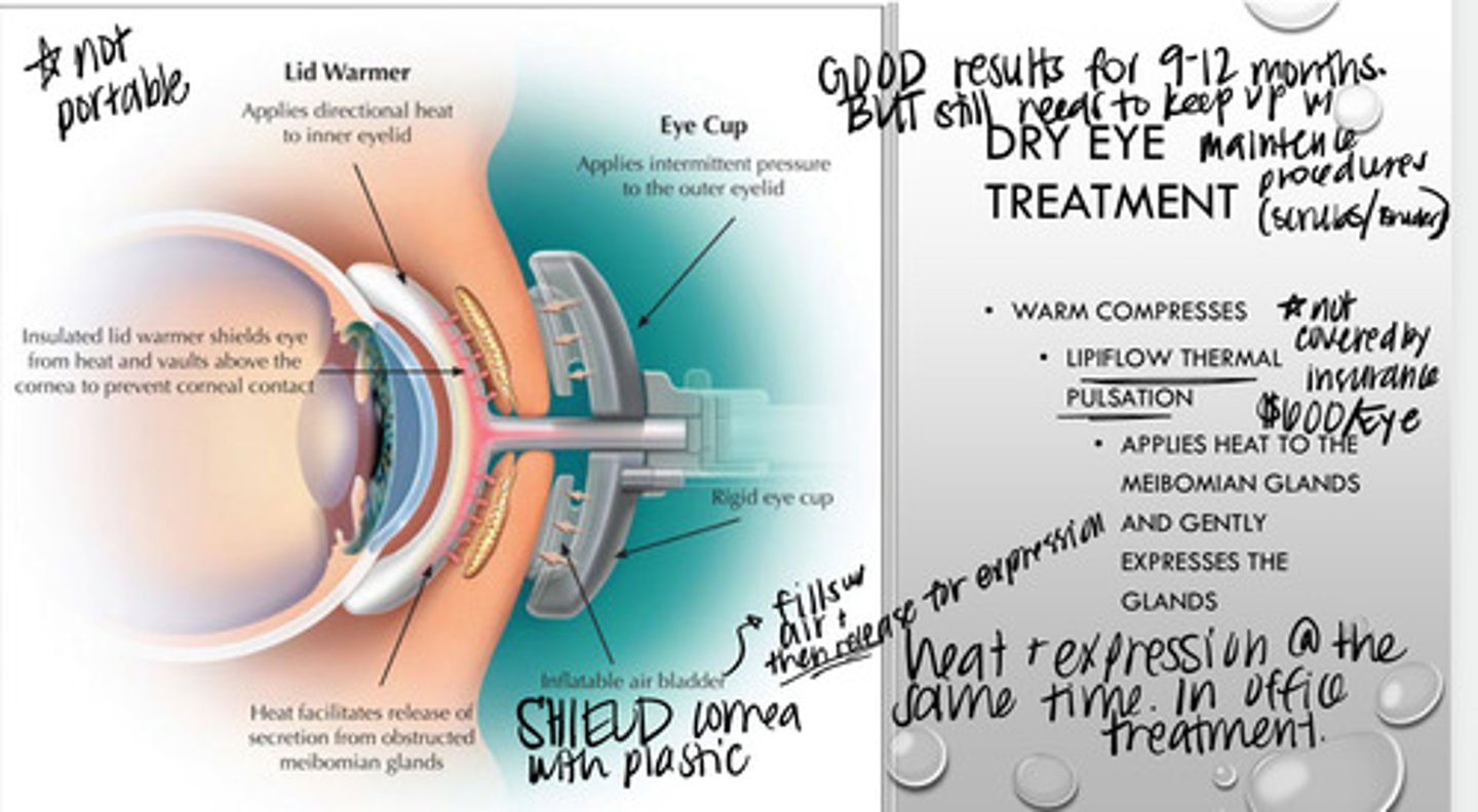 <p>How does lipiflow thermal pulsation work for patients with DED?</p>