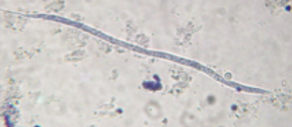 <p>Microfilariae that look like these (300 micrometers long) were found in the blood of an adult beagle. What is their clinical signfiicance?</p>