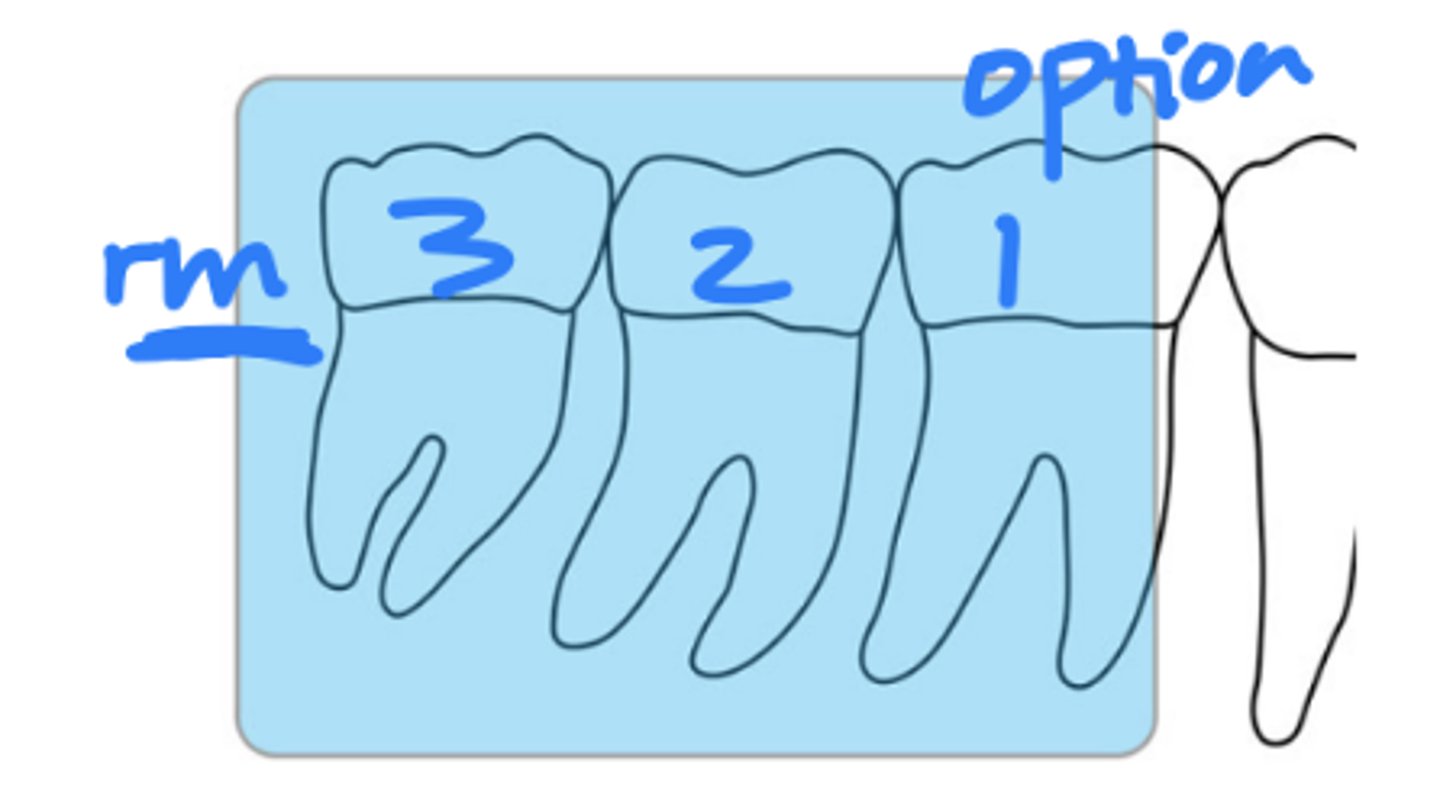 <p>size 2</p><p>2 mm retromolar area, third molar, and second molar</p>