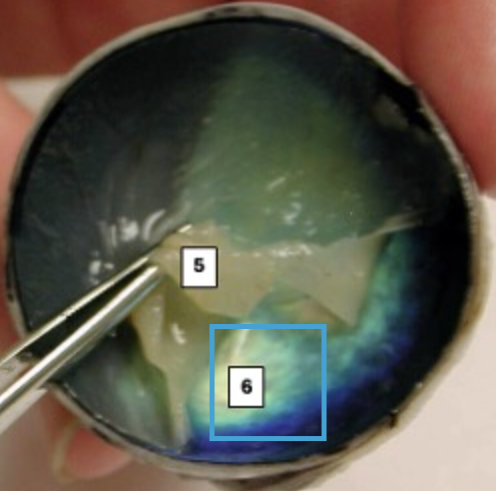 <p>What is this highlighted figure?</p>