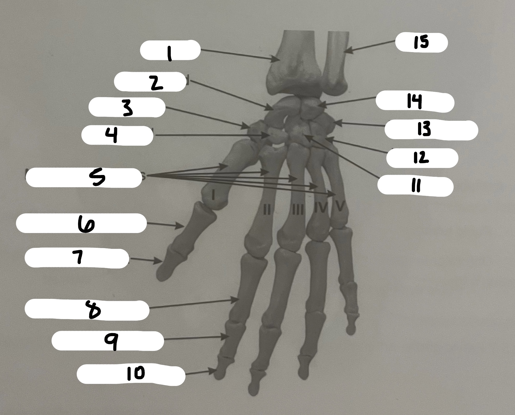 <p>What’s the name of the structure labeled #13?</p>