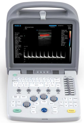 <ul><li><p>Red-orange colour: blood moving in one direction</p></li><li><p>Blue colour: blood moving in opposite direction (towards or away from sensor)</p></li></ul><p></p>