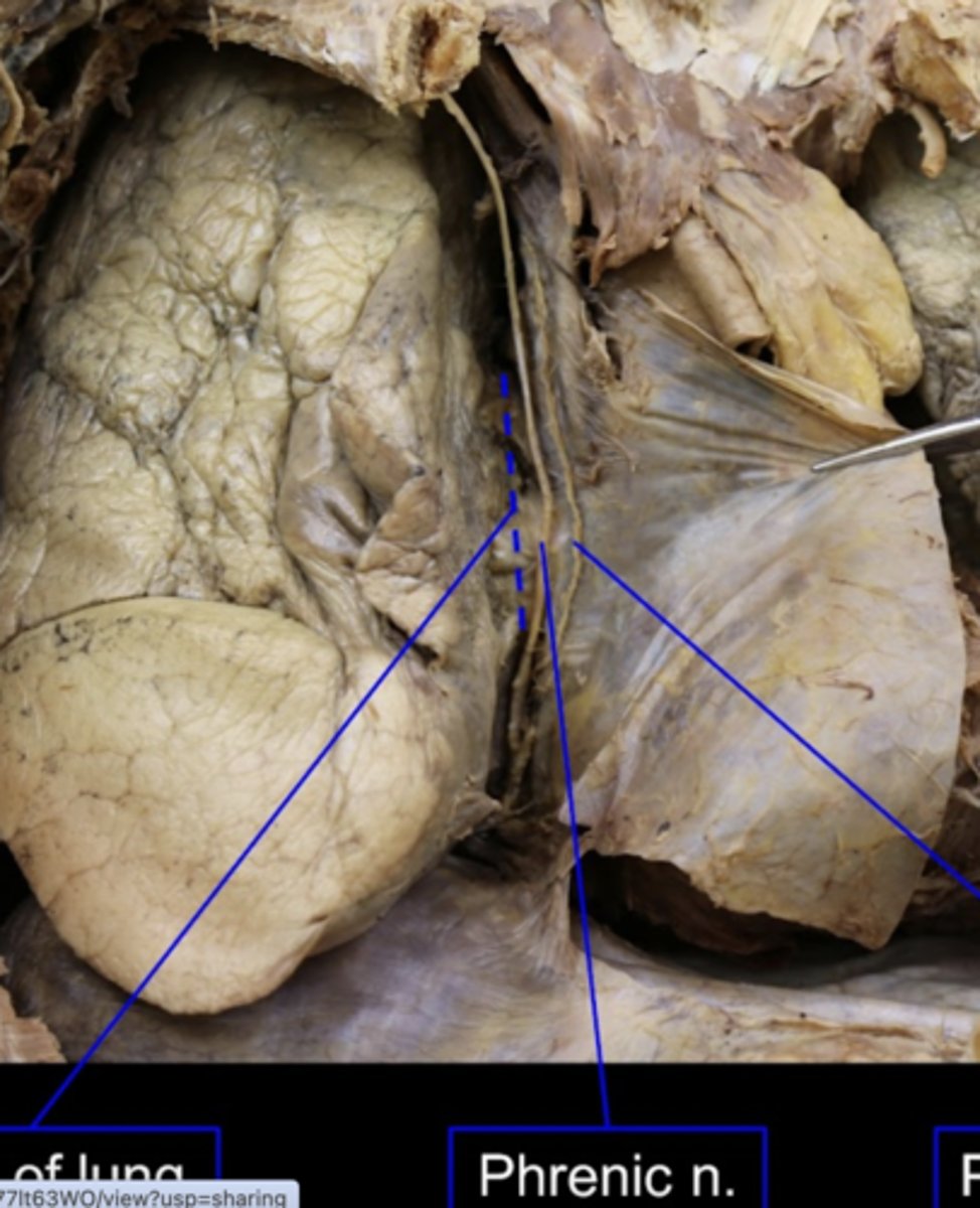 <p>innervates the diaphragm</p>