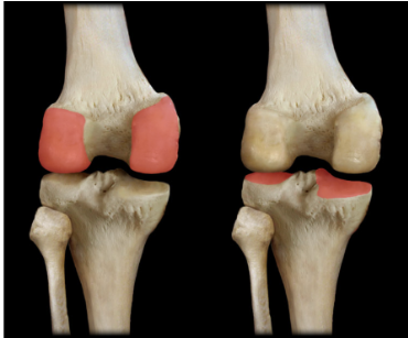 <p>posterior </p><p>anterior view only has one shiny surface // posterior has 2 shiny surfaces/condyles </p>