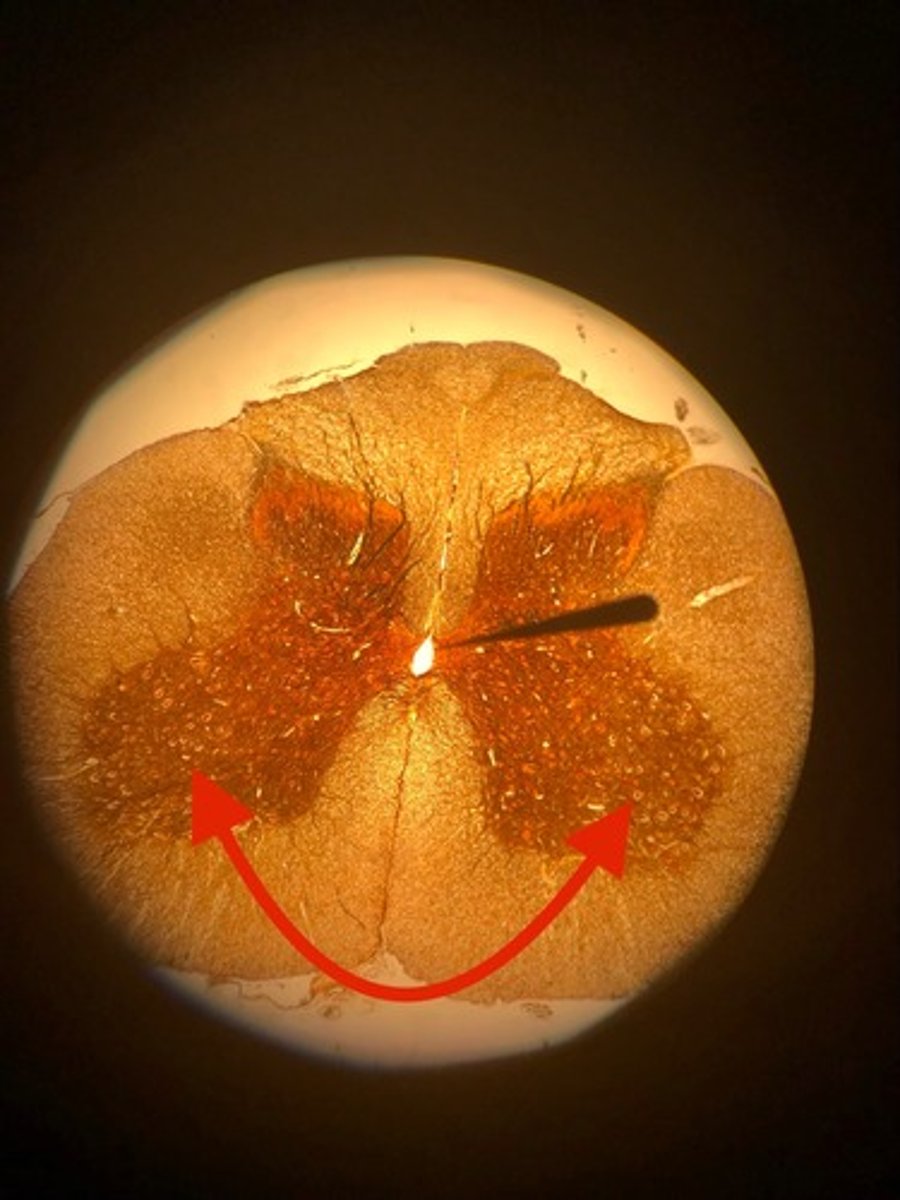 <p>What neurons are found here?</p>