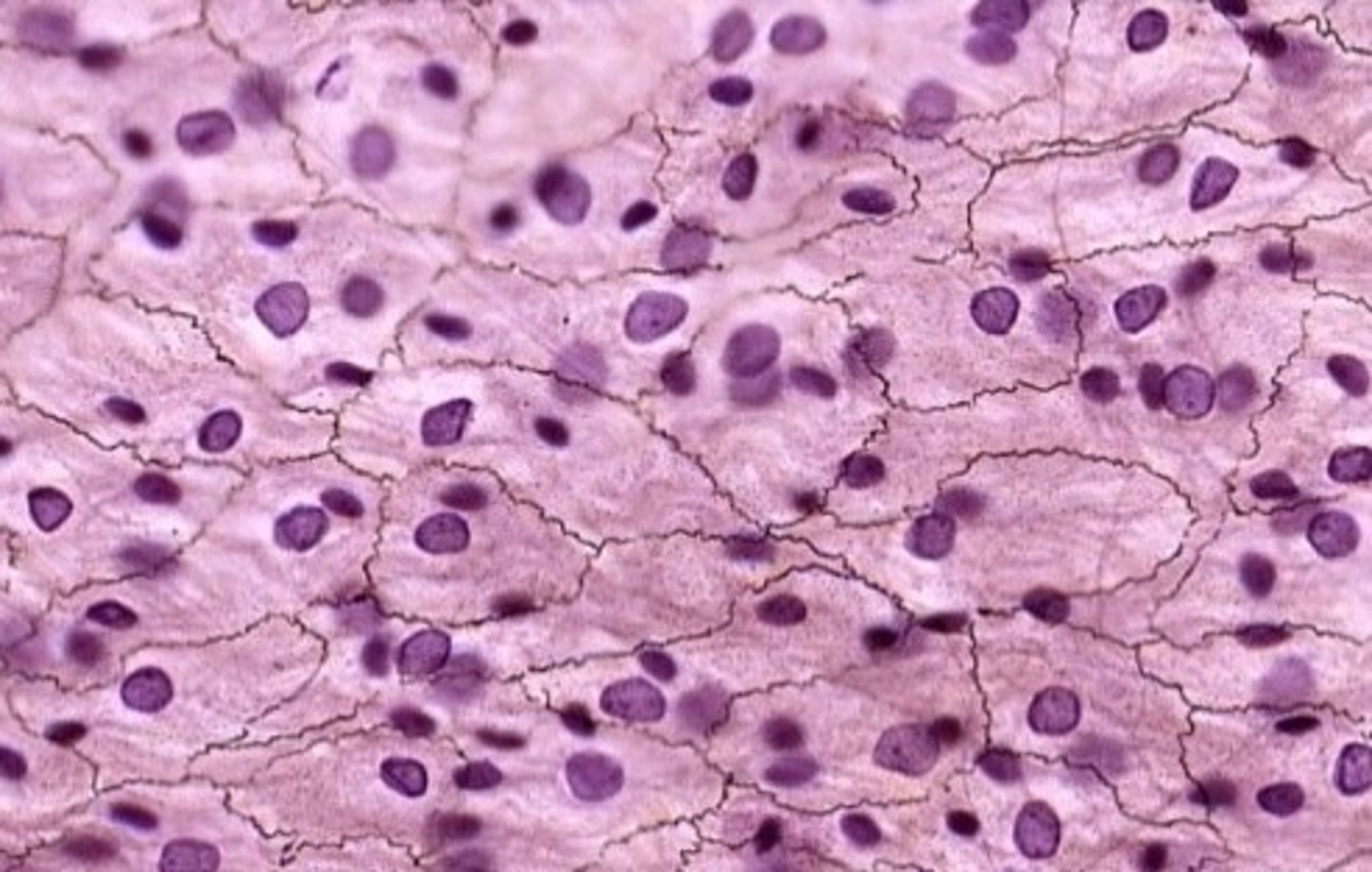 <p>pavement epithelium</p>