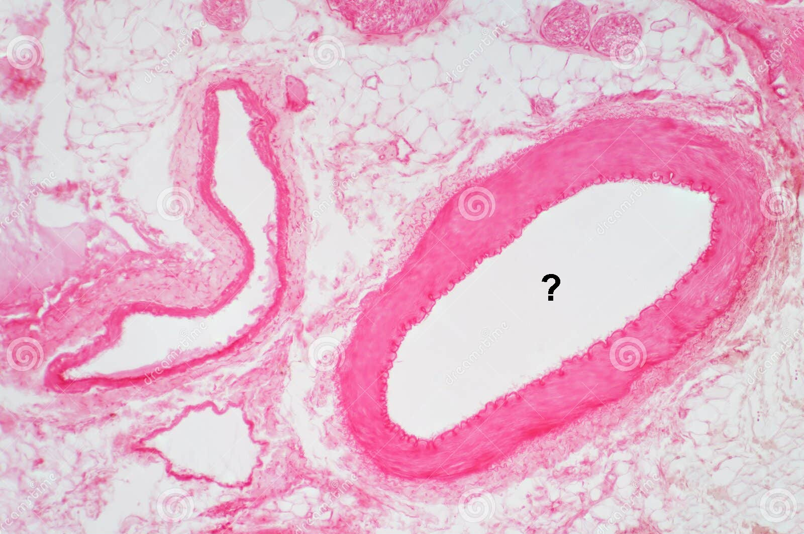 <p>Is this a vein or an artery?</p>