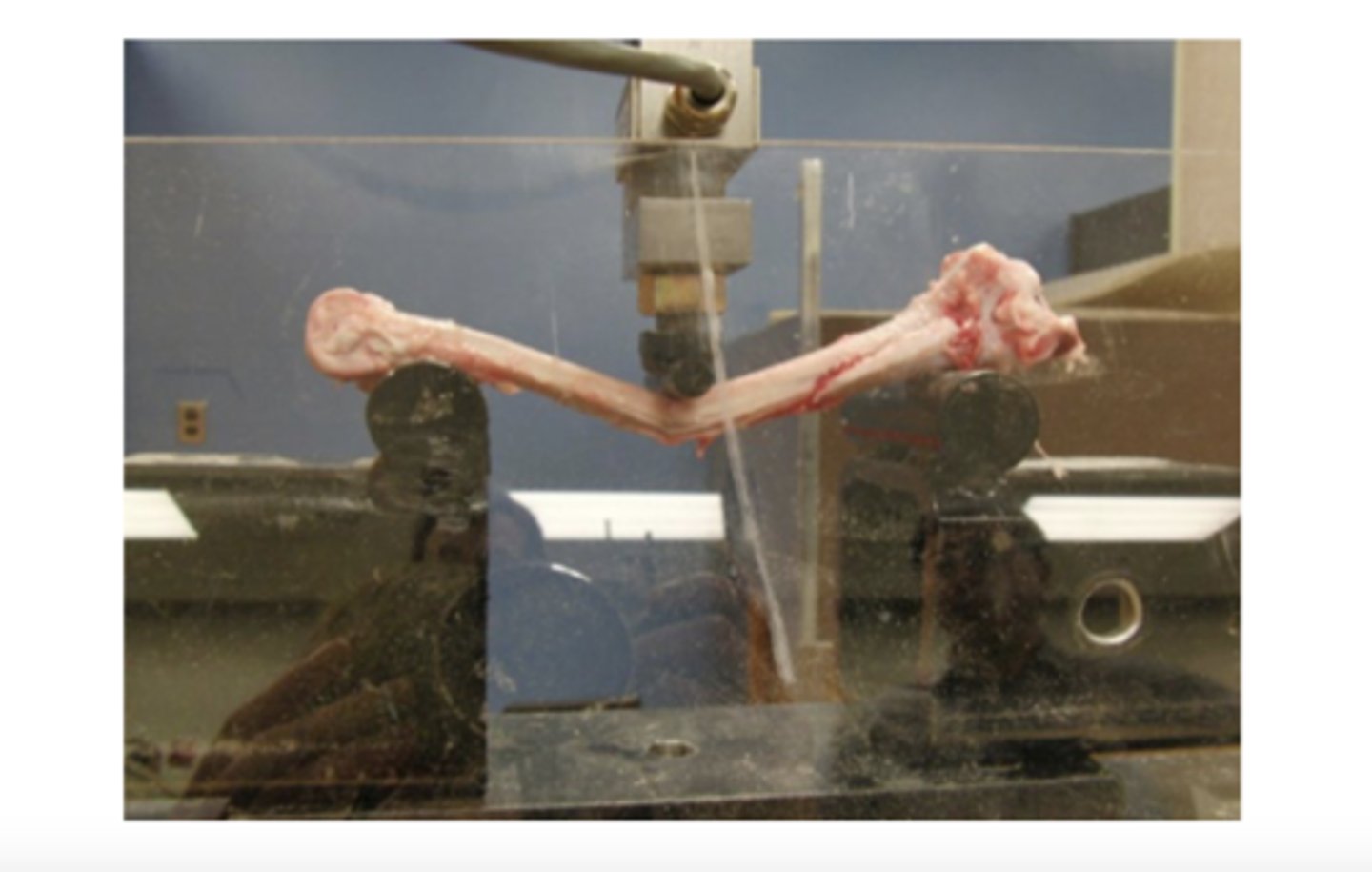 <ul><li><p>deformation of tissue that occurs at right angles to its longitudinal axis</p></li><li><p>concave side undergoes compression load</p></li><li><p>convex side undergoes tension load</p></li></ul><p></p>