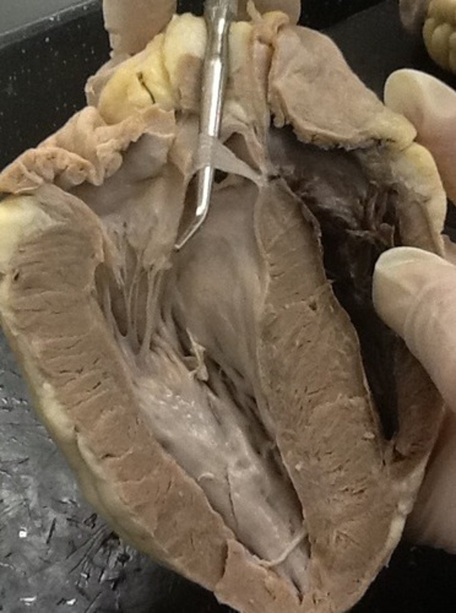 <p>Identify:, The valve that leaves or exits the left ventricle opening/entering the aorta</p>