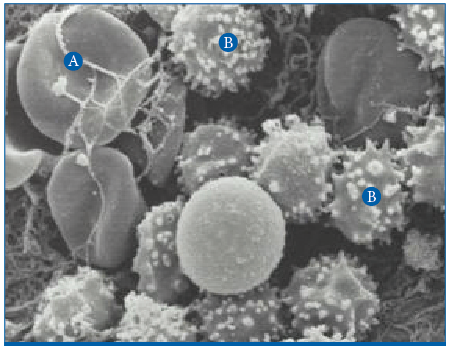 Neutrophils