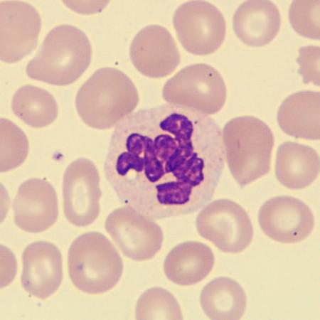 <p>What is this neutrophil showing?</p>