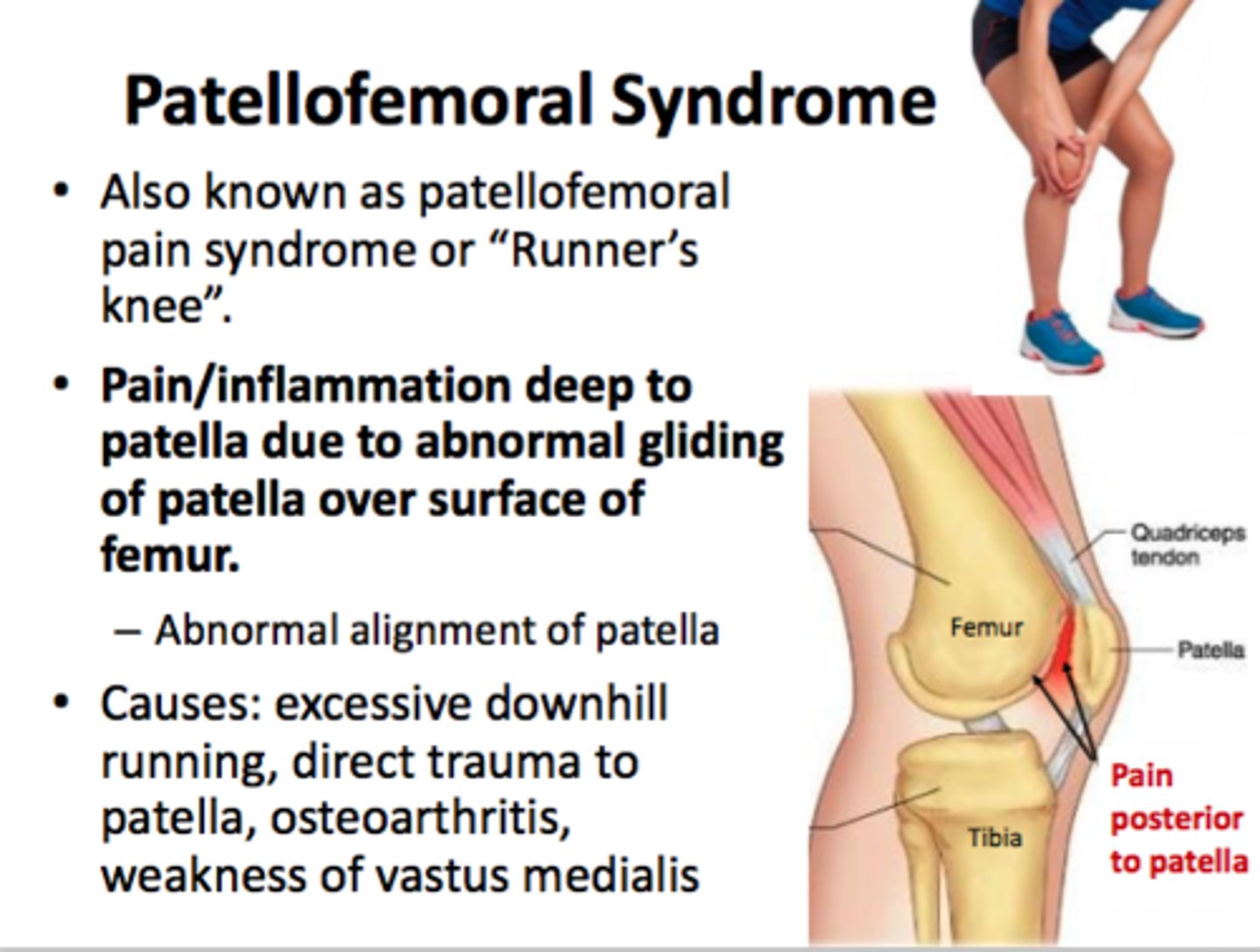 <p>age: 20-50</p><p>moi: trauma, tight ITB, gmax, and TFL</p><p>worsen symptoms after prolonged sitting (moviegoers sign), stairs, and kneeling</p><p>end range knee flexion painful</p><p>tenderness on anterior knee especially with patella compression</p><p>anterior knee swelling</p><p>test: clarke test</p>