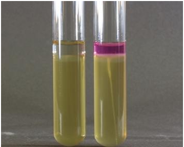 <p>What <strong>biochemical test</strong> is involved in this set-up?</p>