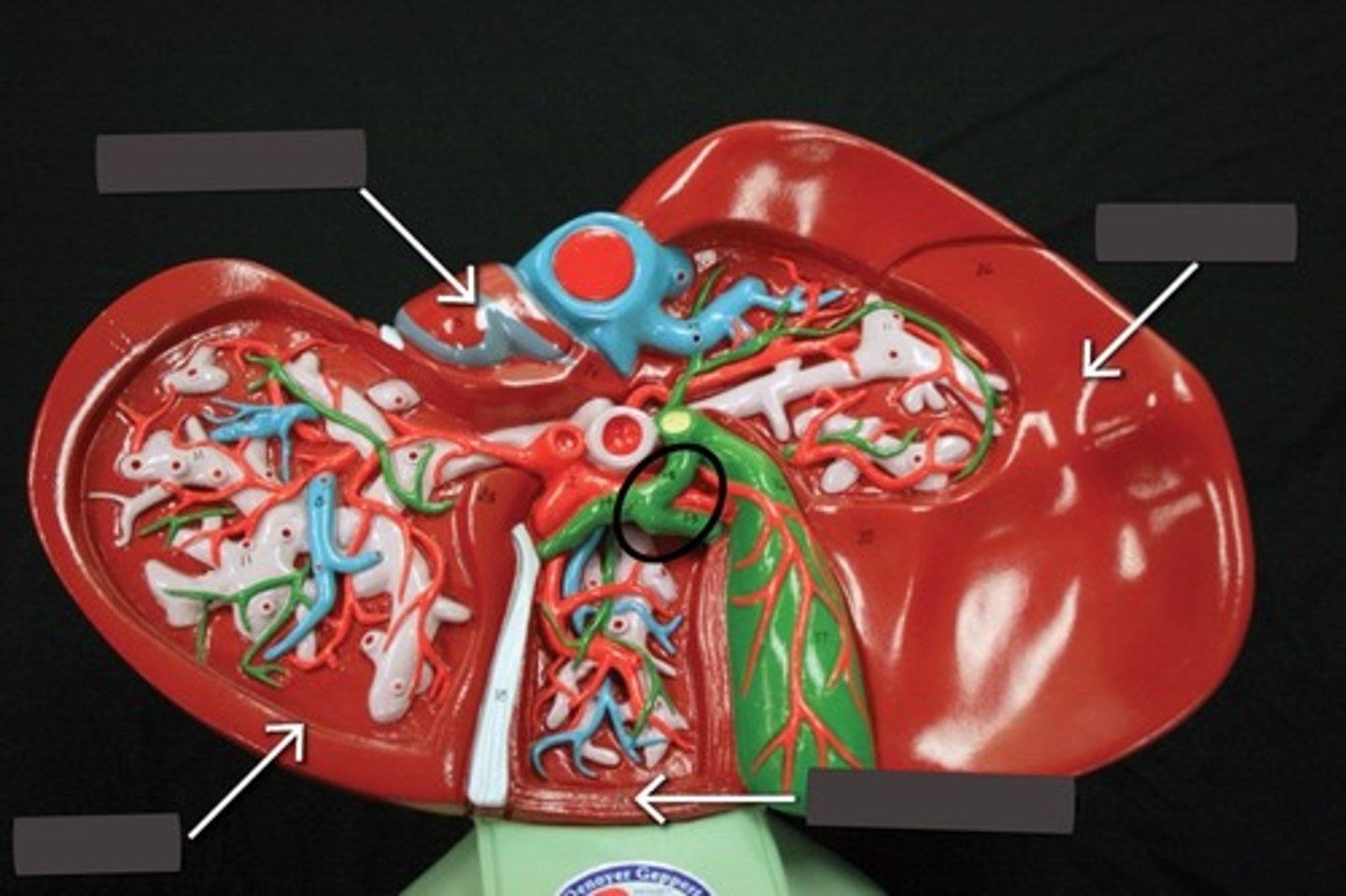 <p>Upper region of the gallbladder</p>