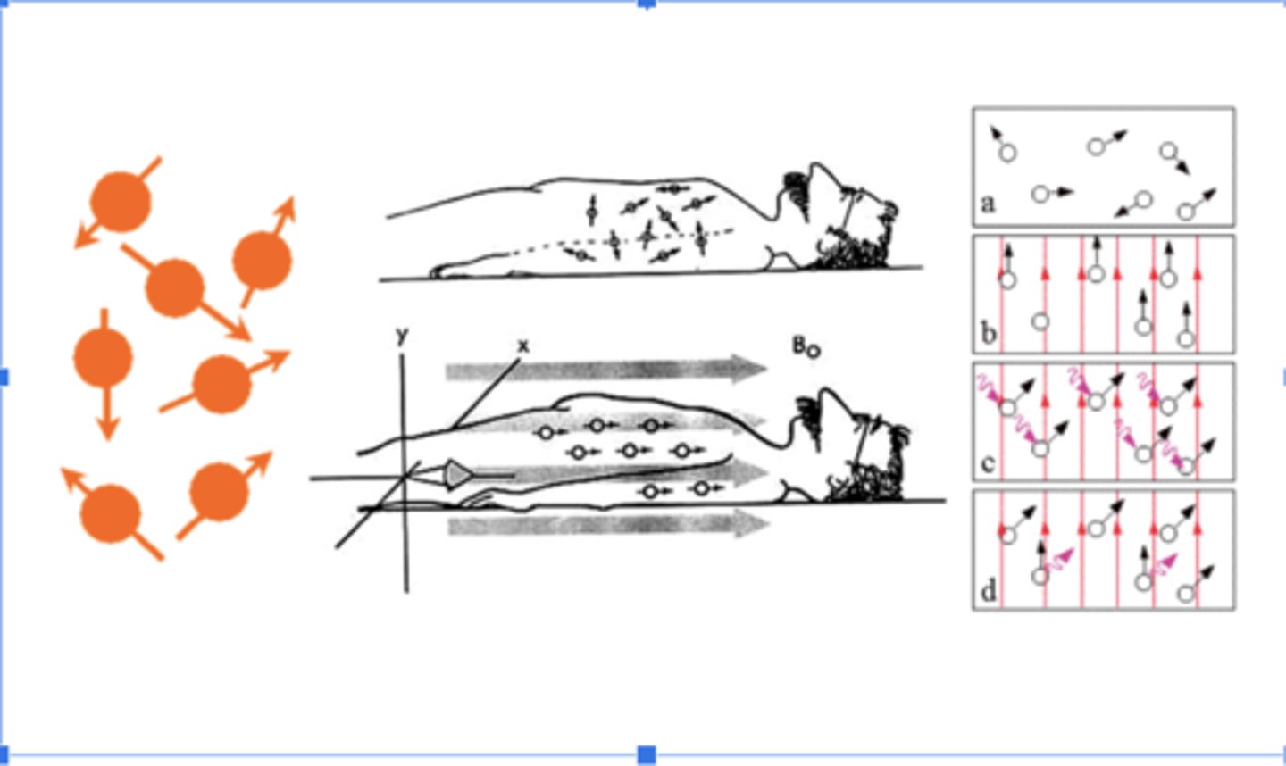<p>Atoms with an odd number of protons and/or neutrons are capable of acting as magnets</p><p>-A strong magnetic field causes hydrogen atoms to align in the same orientation.</p><p>-When a radio frequency wave is passed through the head, atomic nuclei emit electromagnetic energy.</p><p>-The MRI scanner is tuned to detect radiation emitted from the hydrogen molecules.</p><p>-Computer reconstructs image.</p>