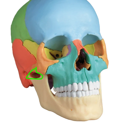 term image