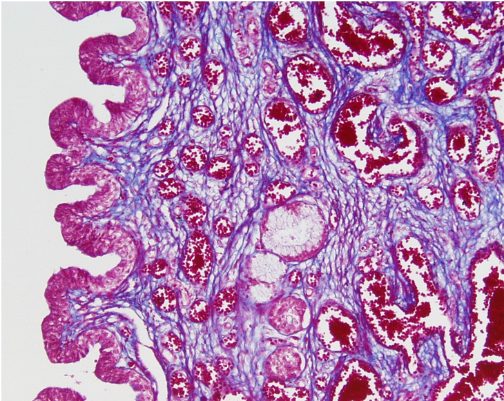 <p>The lumen of the urethra is to the right.  Note the abundance of blood vessels within the corpus spongiosum.</p>