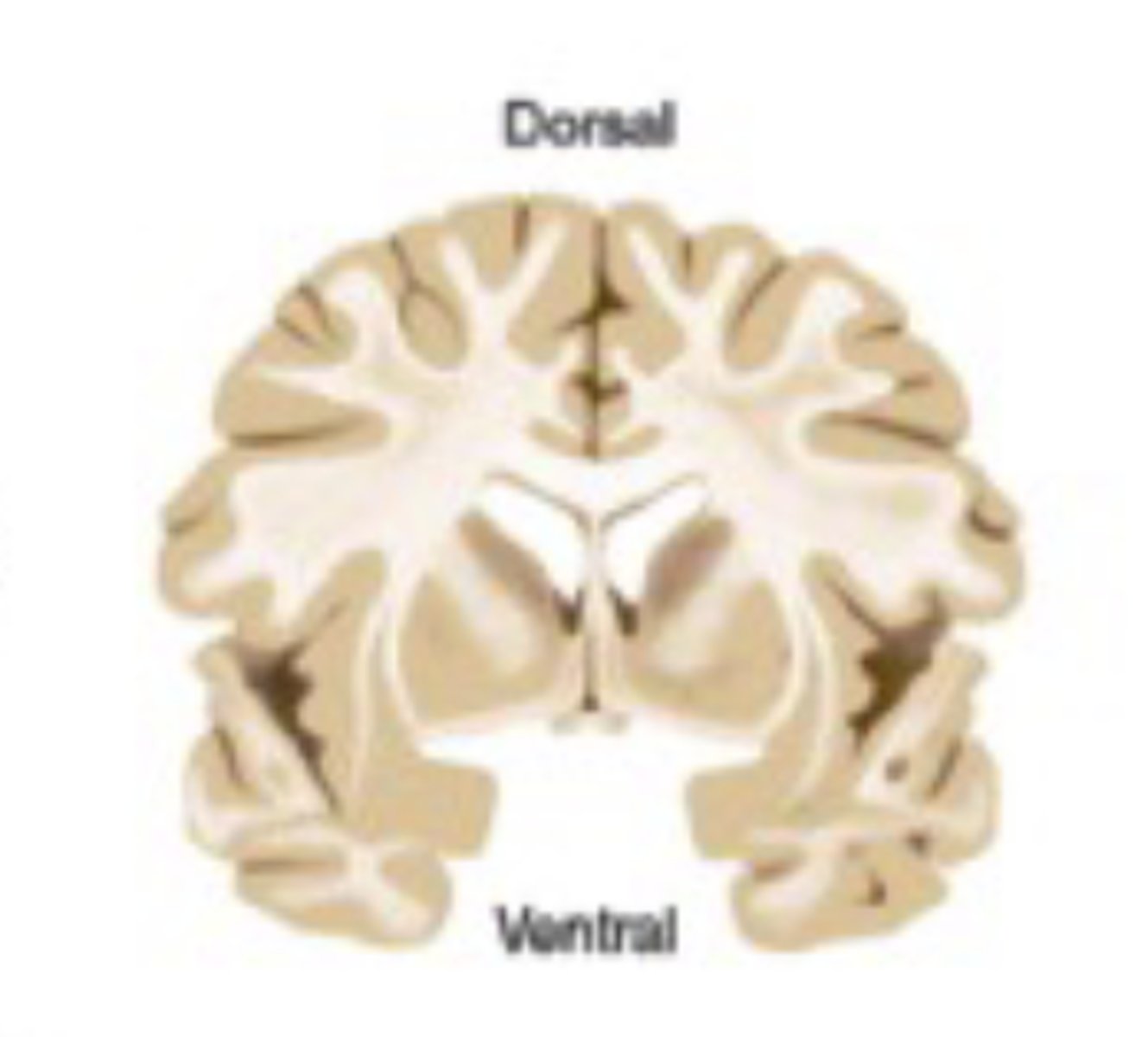 <p>in a direction toward the top of the head or the back</p>