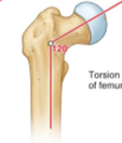 <p>refers to the femur and the angel between the femoral shaft and the vertical axis of the femur </p>