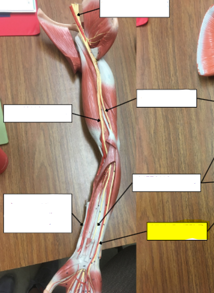 <p>what nerve is highlighted in yellow?</p>