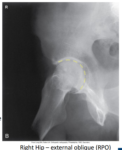 <p>External oblique.</p>