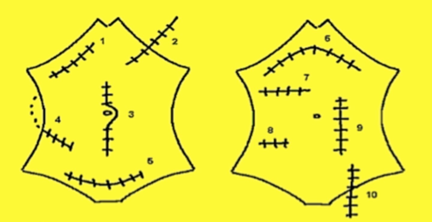 <p>what incision is #10</p>