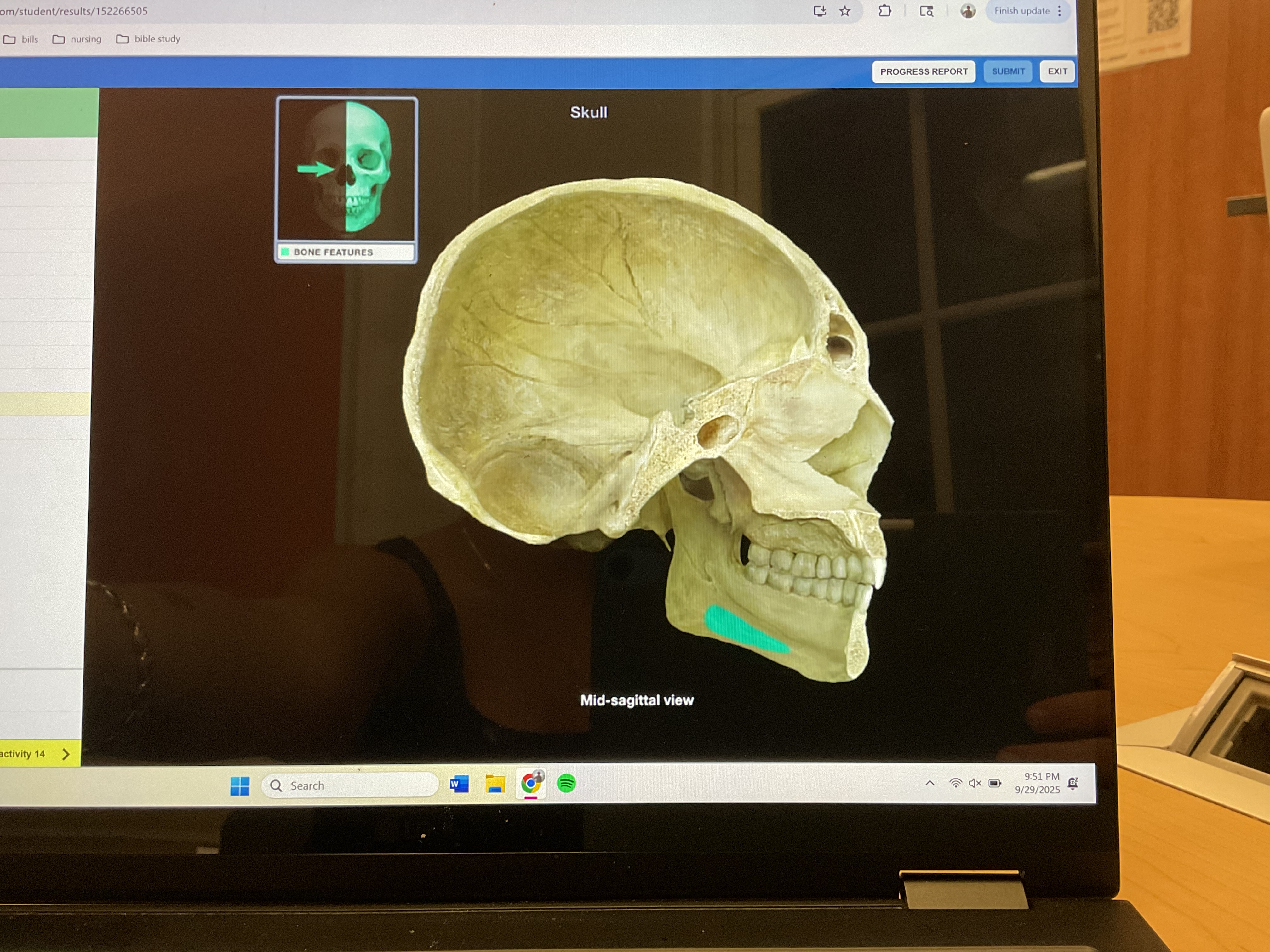<p>Submandibular fossa </p>