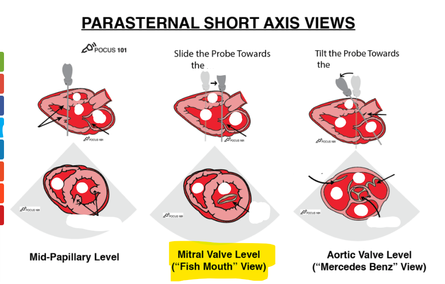 <p>label structures</p>