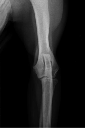 <p>what radiographic view of the elbow is shown?</p>