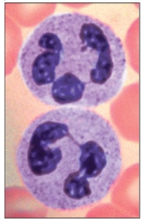 <p>what is this granulocyte?</p>