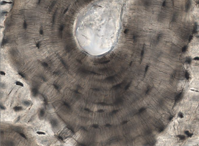<p>layers of intracellular bone matrix</p><p>in this photo, they are arranged in rings</p>
