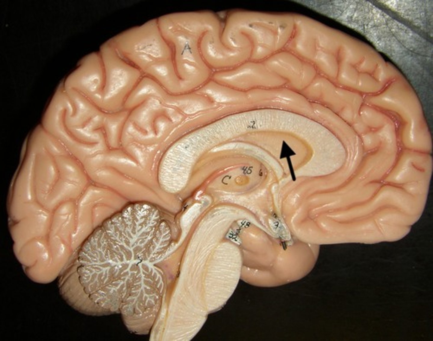 <p>wall that separates lateral ventricles</p>