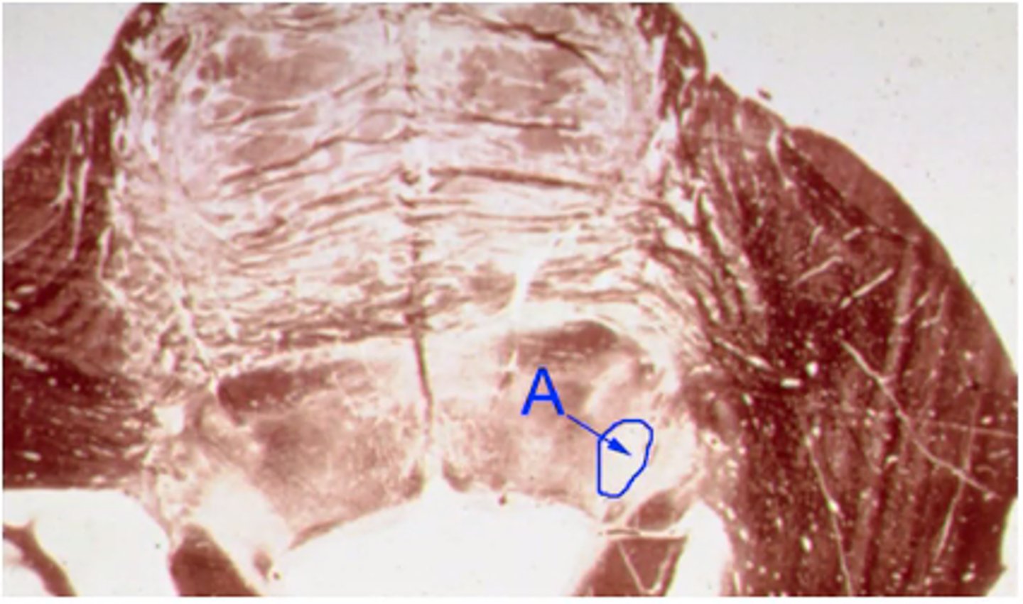 <p>Identify the structures indicated by the outline and letter "A"</p>